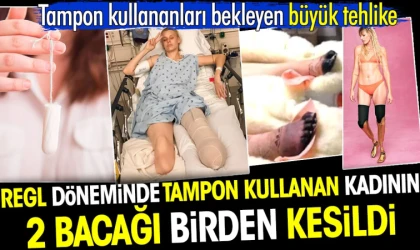 DİKKAT! İKİ BACAĞI KESİLDİ